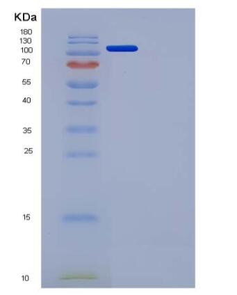 Recombinant Mouse VEGFR3 / FLT-4 Protein (Fc tag)(Fc tag)