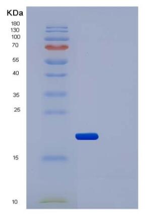 Recombinant Human IL2Ra / CD25 Protein (His tag)