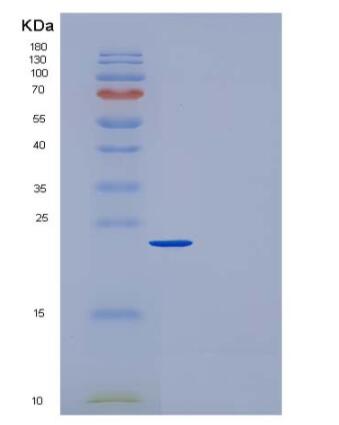 Recombinant Rat CRP / C-Reactive Protein (His tag)