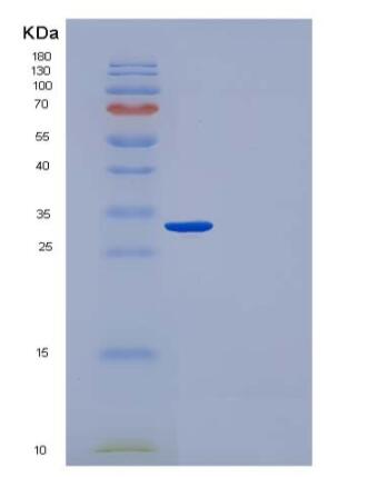 Recombinant Human CUTC / CGI-32 Protein (His tag)