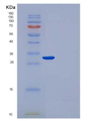 Recombinant Human IgG1 Fc Protein