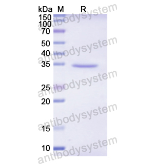 Recombinant Human SERPINA7, N-His