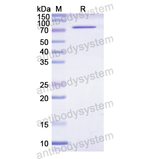 Recombinant Human CD29/ITGB1, N-His