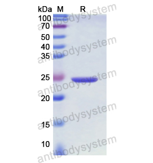 Recombinant Human CD220/INSR, N-His