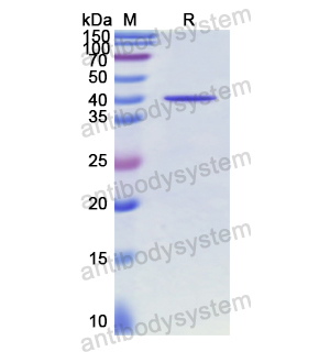 Recombinant Human GLA, N-His