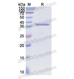 Recombinant Human CCK, N-GST