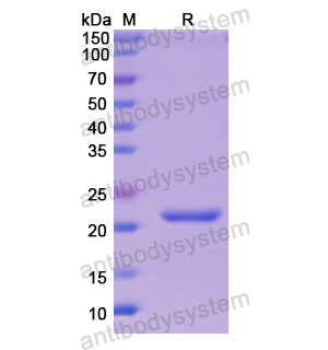 Recombinant Human CD51/ITGAV, N-His