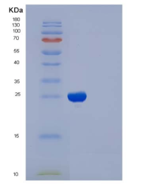 Recombinant Human CD122 / IL-2RB Protein