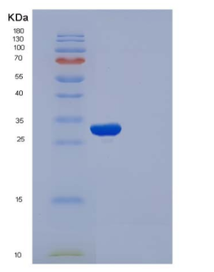 Recombinant Human APOA1 / ApoAI Protein (His tag)