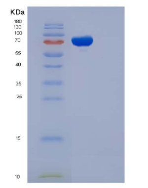 Recombinant Rat GFRA1 / GFR alpha-1 Protein (Fc tag)