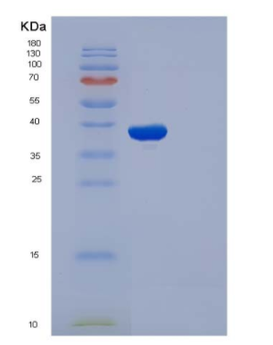 Recombinant Human SELP / selectin P / P-selectin Protein (His tag)