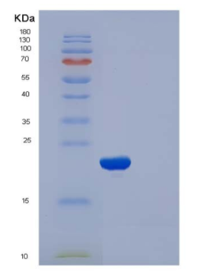 Recombinant Human CFL2 / cofilin 2 / ADF Protein (His tag)