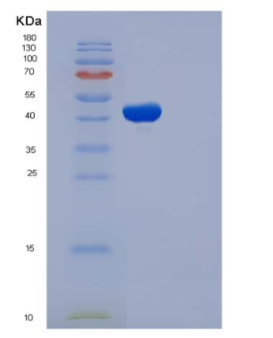 Recombinant Human MAX Protein (His &GST Tag)