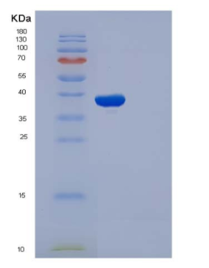 Recombinant Human IL1R1 / CD121a Protein (His tag)