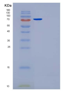 Recombinant Human Fibronectin / Fibronectin Fragment 2 Protein (His tag)