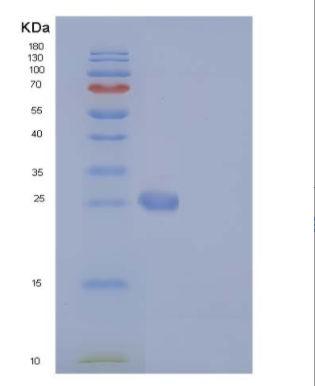 Recombinant Human BCL2L1 / Bcl-XL Protein (His tag)