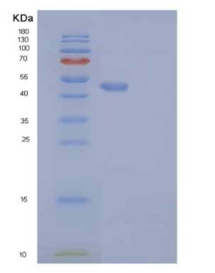 Recombinant Human RAB27B Protein (Fc tag)