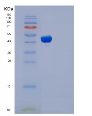 Recombinant Human TCN2 / Transcobalamin-II Protein (His tag)