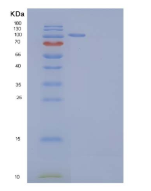 Recombinant Mouse AARS / alanyl-tRNA synthetase Protein (His tag)