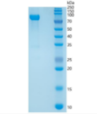 Recombinant Human MMP-2 Protein