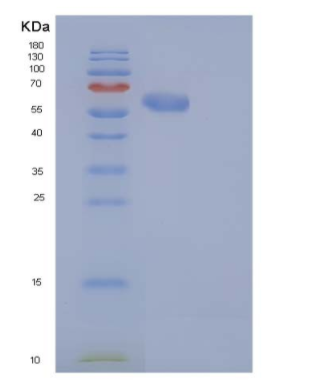 Recombinant Human CAT / Catalase Protein (His tag)