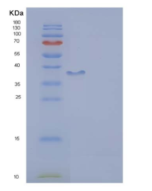 Recombinant Human DCX Protein (aa 45-150, GST tag)