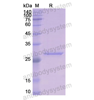 Recombinant Human KLK1, N-His