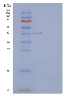 Recombinant Rat ICOS / AILIM / CD278 Protein (Fc tag)