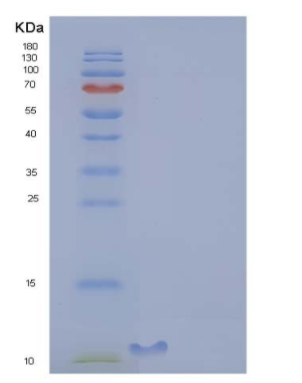 Recombinant Rat CLPS / Colipase Protein (His Tag)