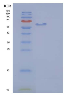 Recombinant Human AFM / Afamin Protein (His tag)