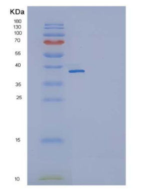 Recombinant Mouse IL11RA / IL11Rα Protein (His tag)