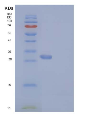 Recombinant Human RAB27B Protein (His tag)