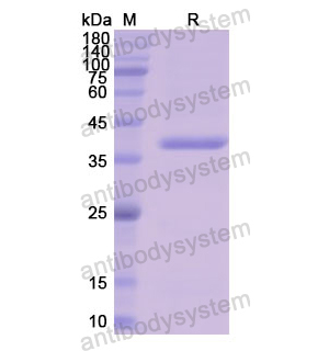 Recombinant Human LDHB, N-His