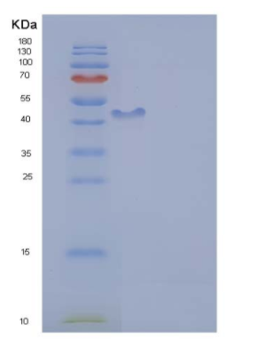 Recombinant Human ICAM-1 Protein