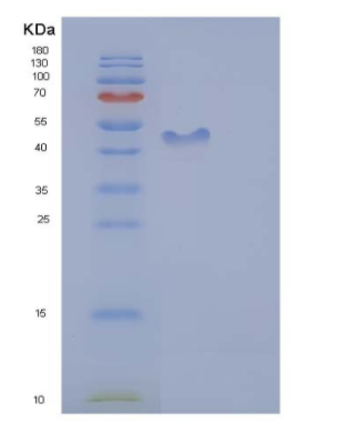 Recombinant Human ICAM-2 / CD102 Protein (His & Fc tag)