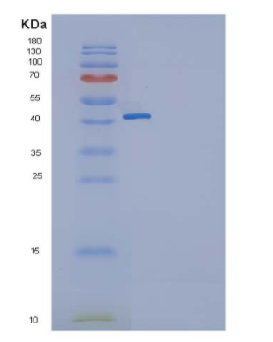 Recombinant Human GITR / TNFRSF18 Protein (Fc tag)