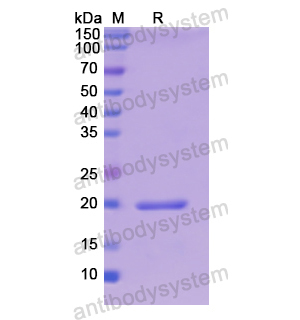 Recombinant Human NEFL, N-His