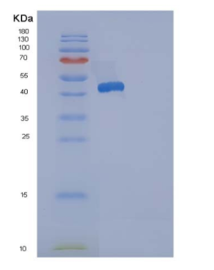 Recombinant Human ACP1 / LMW-PTP Protein (GST tag)