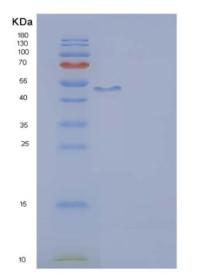 Recombinant Human IL2RG / CD132 Protein (Fc tag)