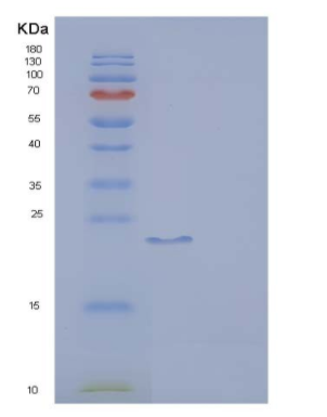 Recombinant Human CD32a / FCGR2A Protein (167 His, His & AVI tag)