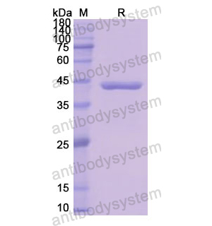 Recombinant Human NEFM, N-His