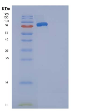 Recombinant Mouse SELP / selectin P / P-selectin Protein (His tag)