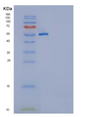 Recombinant Rat KIT / c-KIT Protein (His tag)