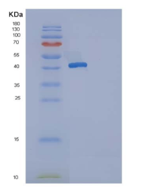 Recombinant Human Osteoprotegerin / TNFRSF11B Protein (His tag)