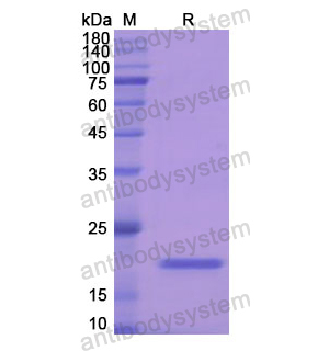 Recombinant Human GPX1, N-His