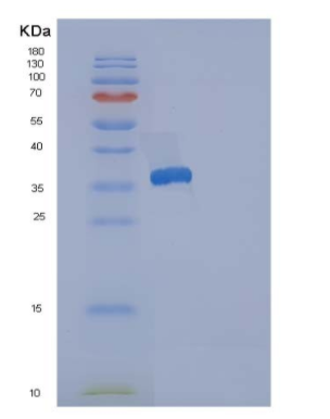 Recombinant Human Reticulocalbin 3 Protein (His Tag)