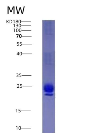 Eukaryotic Interleukin 1 Receptor Antagonist (IL1RA)