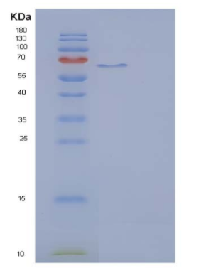 Recombinant Rat IL23R / IL23 Receptor Protein (Fc tag)