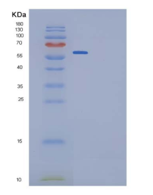 Recombinant Rat IL-6R / CD126 Protein (Fc tag, ECD)