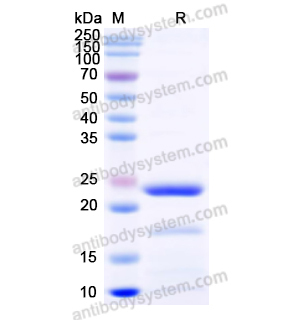 Recombinant Human PROS1, N-His